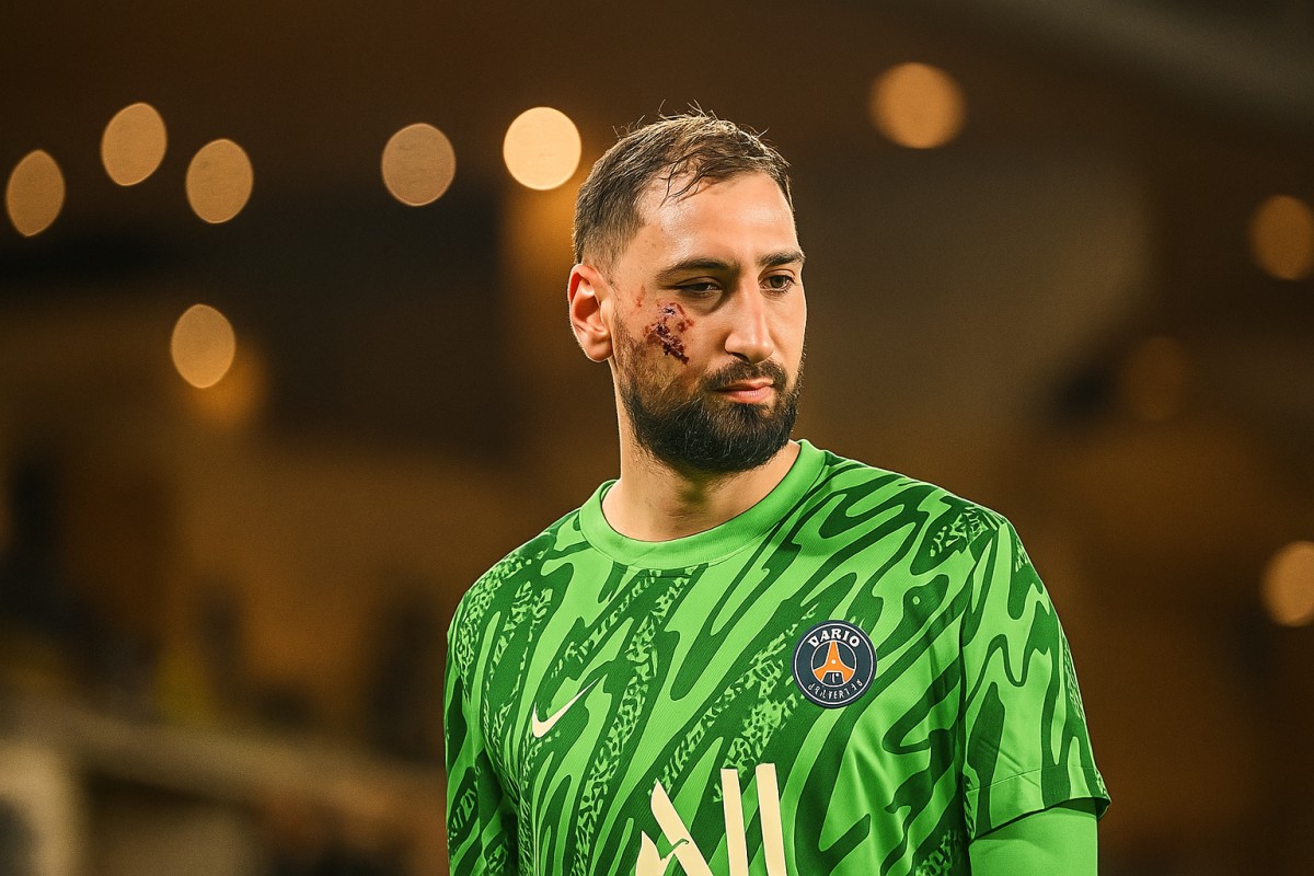blessure-donnarumma-au-visage.jpg